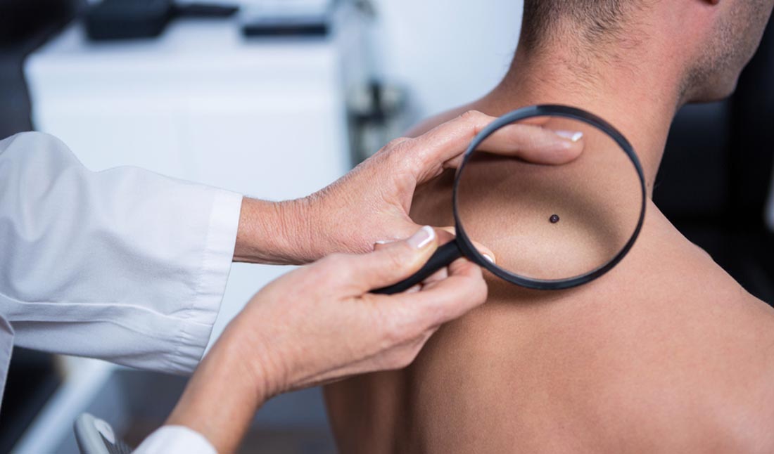 dermatologist examining mole