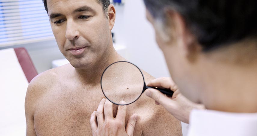 dermatologist examining mans shoulder