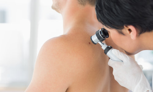 doctor examining mole on back