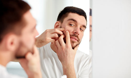 young man squeezing blemish